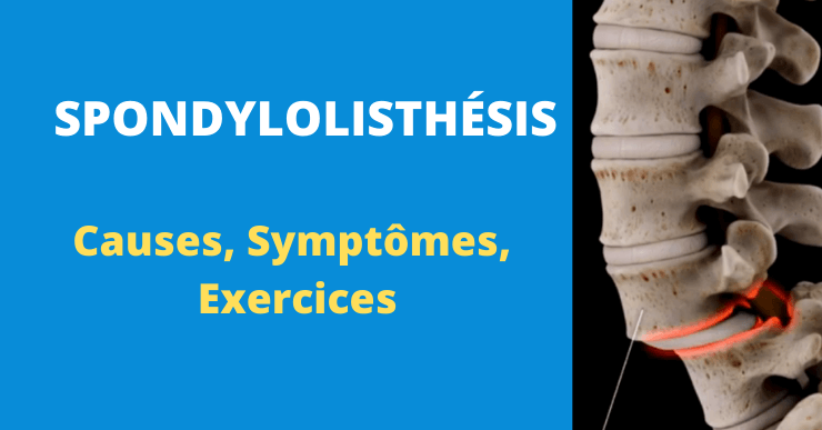 spondylolisthesis exercices