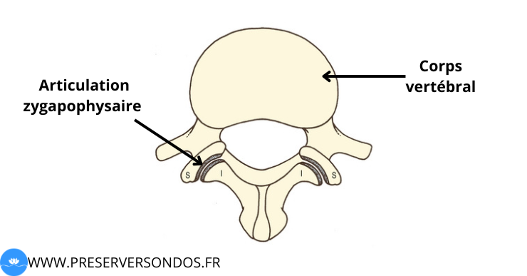 arthrose zygapophysaire schéma